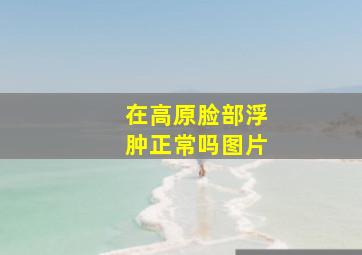 在高原脸部浮肿正常吗图片