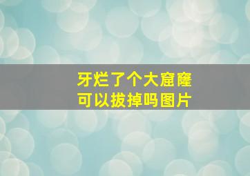 牙烂了个大窟窿可以拔掉吗图片