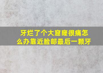 牙烂了个大窟窿很痛怎么办靠近脸部最后一颗牙