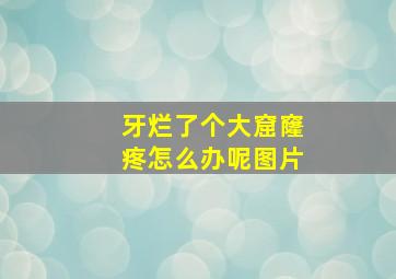 牙烂了个大窟窿疼怎么办呢图片