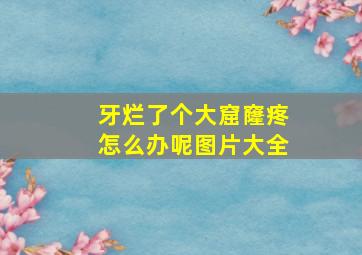 牙烂了个大窟窿疼怎么办呢图片大全