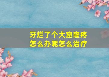 牙烂了个大窟窿疼怎么办呢怎么治疗