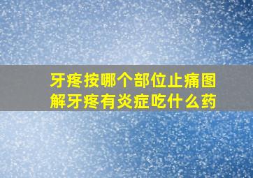 牙疼按哪个部位止痛图解牙疼有炎症吃什么药