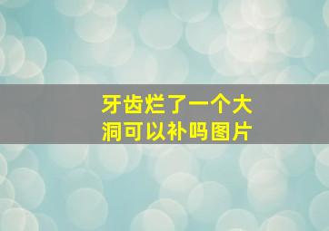 牙齿烂了一个大洞可以补吗图片