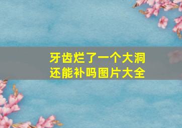 牙齿烂了一个大洞还能补吗图片大全