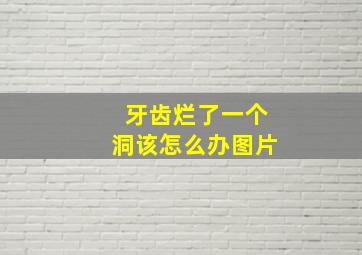 牙齿烂了一个洞该怎么办图片