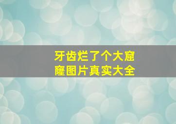 牙齿烂了个大窟窿图片真实大全