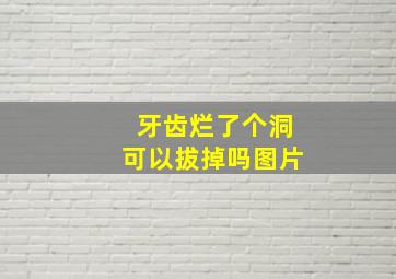 牙齿烂了个洞可以拔掉吗图片